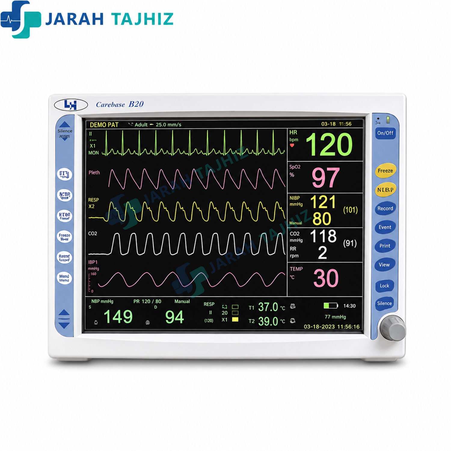 مانیتورینگ-صاایران-LX110 مانیتور علائم حیاتی صاایران مدل LX110 - Image 1
